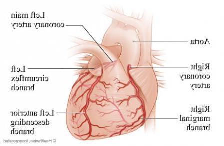 Coronary artery diagram